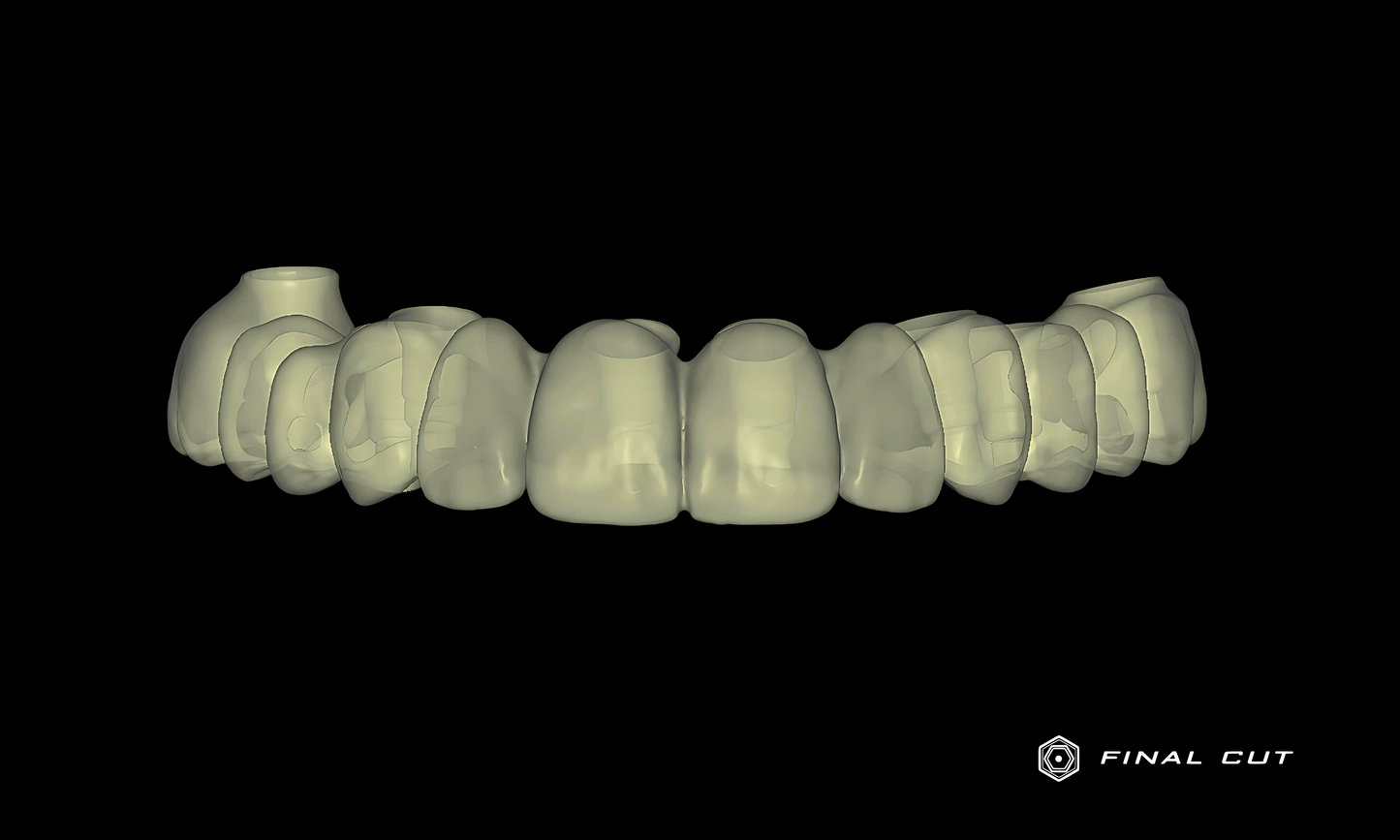 Zirconia Hybrid Full Arch - Design & Milling Service - FinalCut™