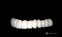 Zirconia Hybrid Full Arch - Design & Milling Service - FinalCut™